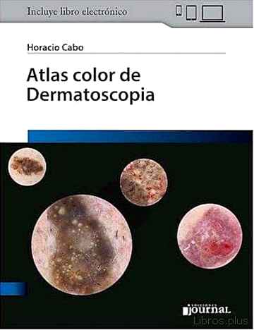 Descargar gratis ebook ATLAS COLOR DE DERMATOSCOPIA (LIBRO + E-BOOK) en epub